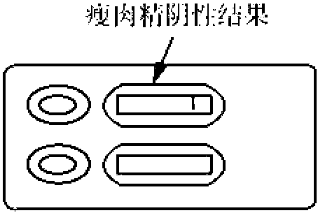 二十三、鹽酸克倫特羅中毒